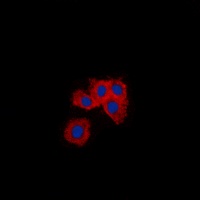 Vimentin Rabbit Polyclonal Antibody