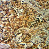 Anti-VIPR1 Antibody