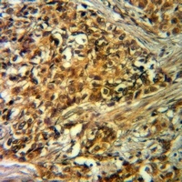 VIPR1 antibody