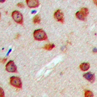 WASF3 antibody