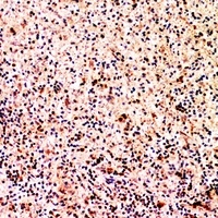 Anti-XCL1 Antibody