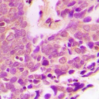 XIAP Antibody