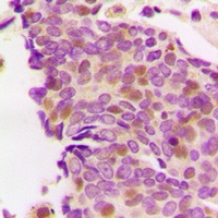 Anti-PS1D Antibody