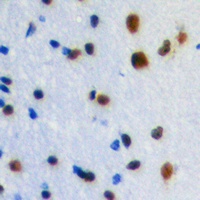 Anti-ZIC1/2/3 Antibody