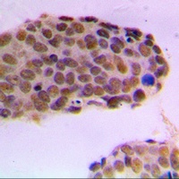Anti-RACK7 Antibody