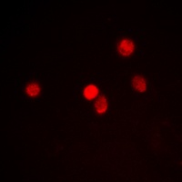 Anti-RACK7 Antibody