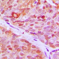Anti-ZNF148 Antibody