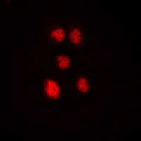 Anti-ZNF148 Antibody
