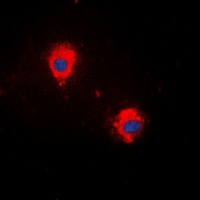 Anti-MARCH5 Antibody