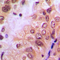 Anti-ABL1 (Phospho-Y204) Antibody