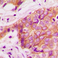 Anti-Alpha-adducin (Phospho-T445) Antibody