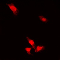 Anti-AKT (Phospho-S473) Antibody