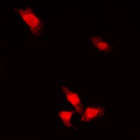 AKT (phospho-S473) antibody