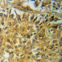 Anti-PRAS40 (Phospho-T246) Antibody