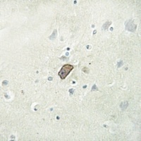ARMCX1 Antibody