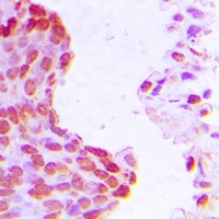 Anti-HIF1 beta Antibody