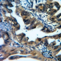 ATG16L1 antibody