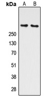 ATM (Phospho-S1981) Antibody