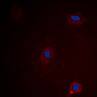 Ataxin 1 (Phospho-S775) Antibody