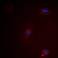 Ataxin 1 (phospho-S775) antibody