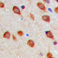 Aurora A (Phospho-T288) Antibody