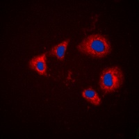 Aurora A (phospho-T288) antibody