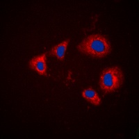 Aurora A (Phospho-T288) Antibody