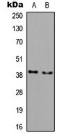 DGAT2L3 Rabbit Polyclonal Antibody