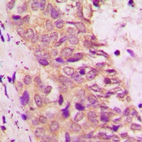 BAD Antibody