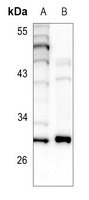 BCL2 Antibody