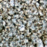 BCL2 Antibody