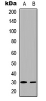 BCLX (Phospho-T47) Antibody