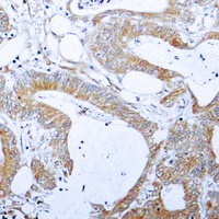 BCLX (Phospho-T47) Antibody