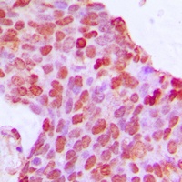 BCOR Antibody