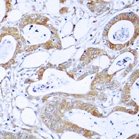 Anti-BCR Antibody