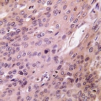 BMP6 Antibody