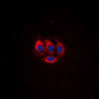 Anti-BMX (Phospho-Y566) Antibody