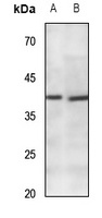 CACNG7 Rabbit Polyclonal Antibody