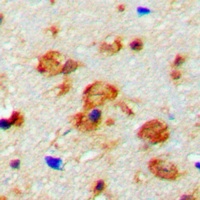Anti-CaMK2 beta/gamma (Phospho-T287) Antibody