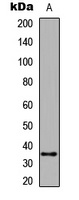 Caspase 6 Antibody