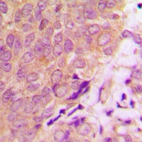 Caspase 6 antibody