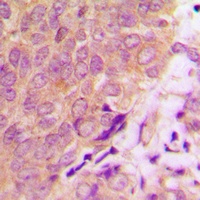 Caspase 6 Antibody