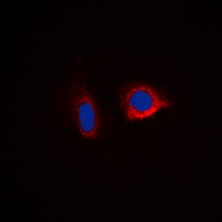 Caspase 6 Antibody