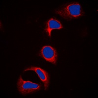 c-CBL (phospho-Y700) antibody