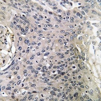 Cerebellin 3 Antibody