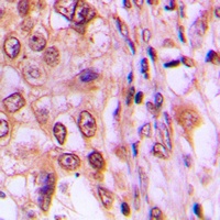 Anti-Cyclin D1 (Phospho-T286) Antibody