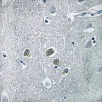 Anti-CDC42EP5 Antibody