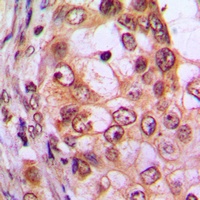 Anti-CDKL1 Antibody