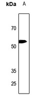 p57 Kip2 Antibody