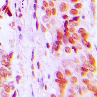 p57 Kip2 Antibody
